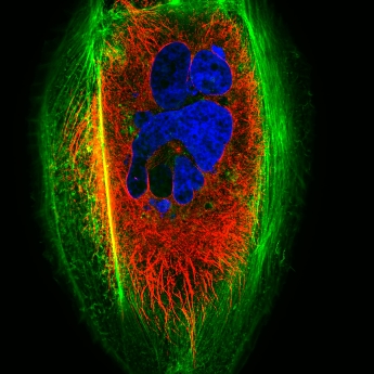 Agresivní nádorová buňka