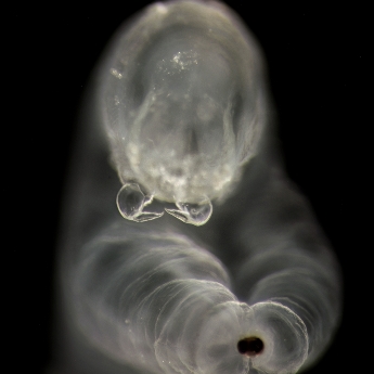 Antarctic Parasitic Copepod