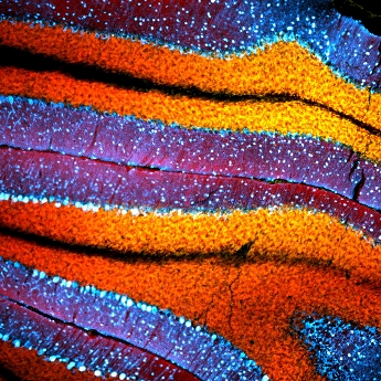 Landscape of brain